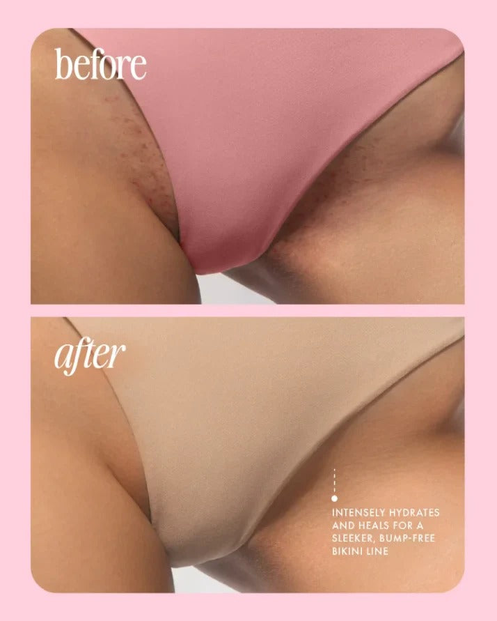 5-Second Post-Hair Removal Serum